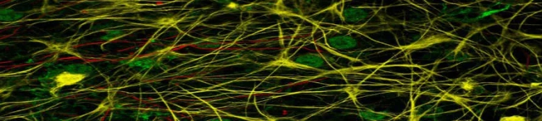 Fluorescent microscopy image showing a complex network of neuronal cells with highlighted structures.